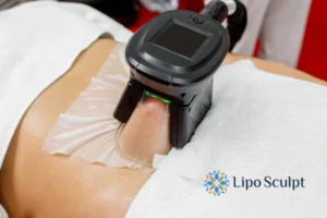 Cryolipolysis Helping You Getting that Perfect Summer Body 3 Cryolipolysis Banstead can give you the best summer body - contact us today!
