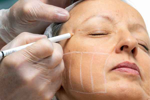 CryoPen: 5 Skin Concerns It May Be Used to Treat 4 What should you ask before having CryoPen treatment Banstead?